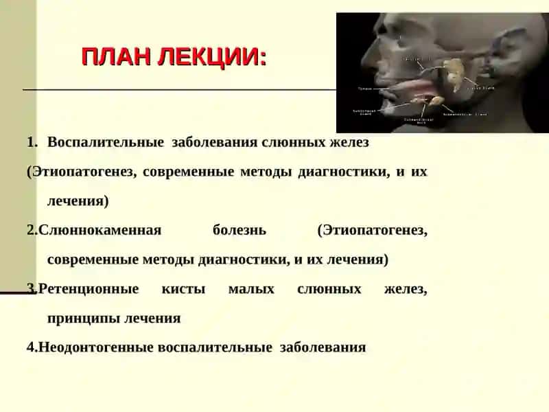 ВОСПАЛИТЕЛЬНЫЕ ЗАБОЛЕВАНИЯ СЛЮННЫХ ЖЕЛЕЗ, СЛЮННОКАМЕННАЯ БОЛЕЗНЬ, РЕТЕНЦИОННЫЕ КИСТЫ МАЛЫХ СЛЮННЫХ ЖЕЛЕЗ, НЕОДОНТОГЕННЫЕ ВОСПАЛИТЕЛЬНЫЕ ЗАБОЛЕВАНИЯ 2