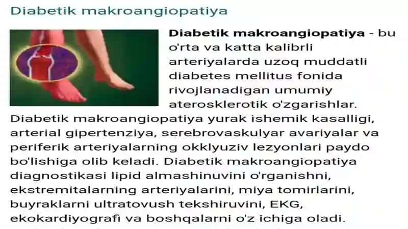 Diabetik makroangiopatiyalar 2