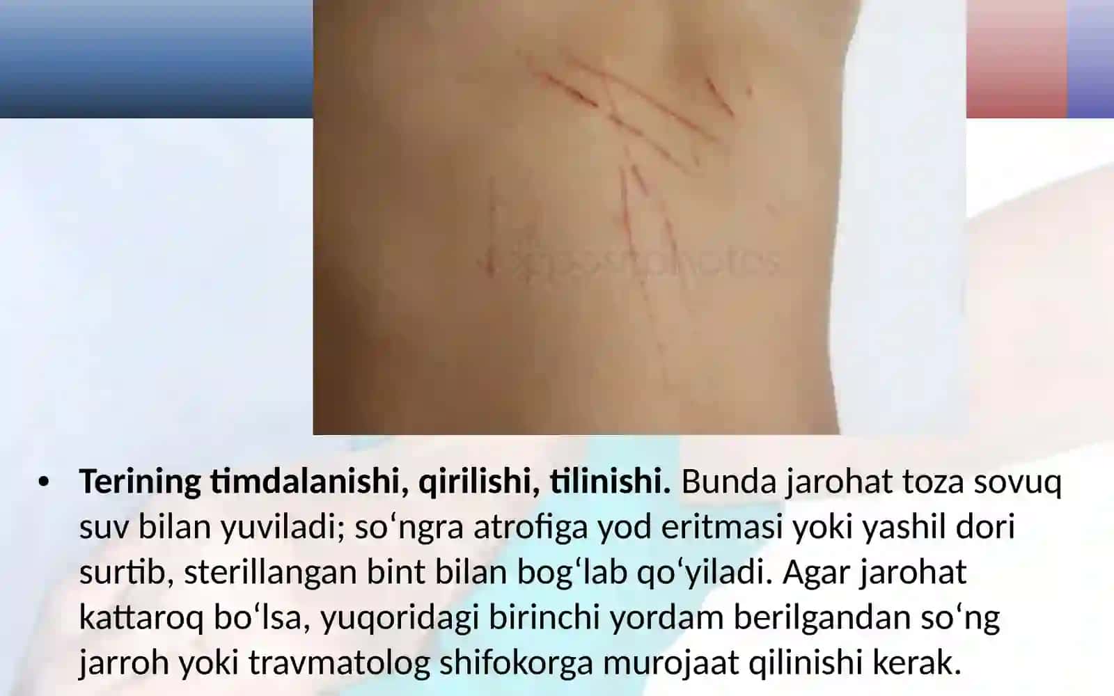 Teri shikastlanganda birinchi yordam 2