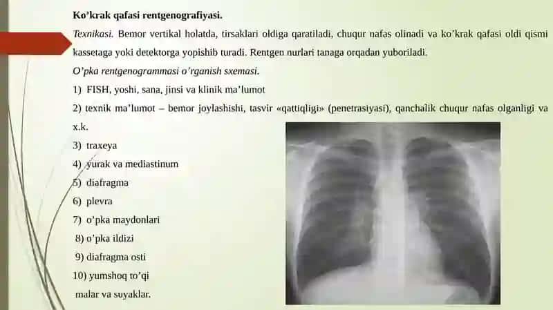 Nafastizimirentgenologik tekshiruvi 2
