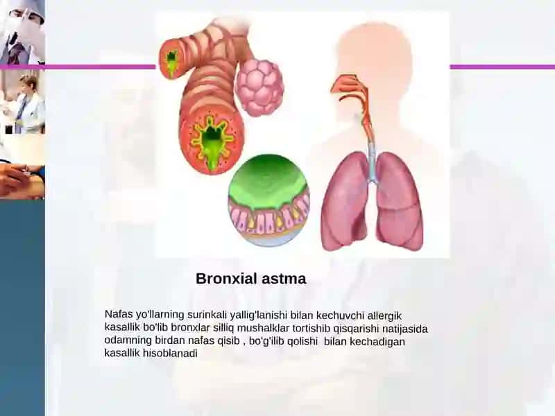 Bronxit Asmada Bo'g'ilishi Xurujlarini Oldini Olish 2