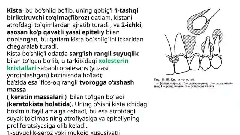 Jag`suyaklarining odontogen epitelial kistalari 2