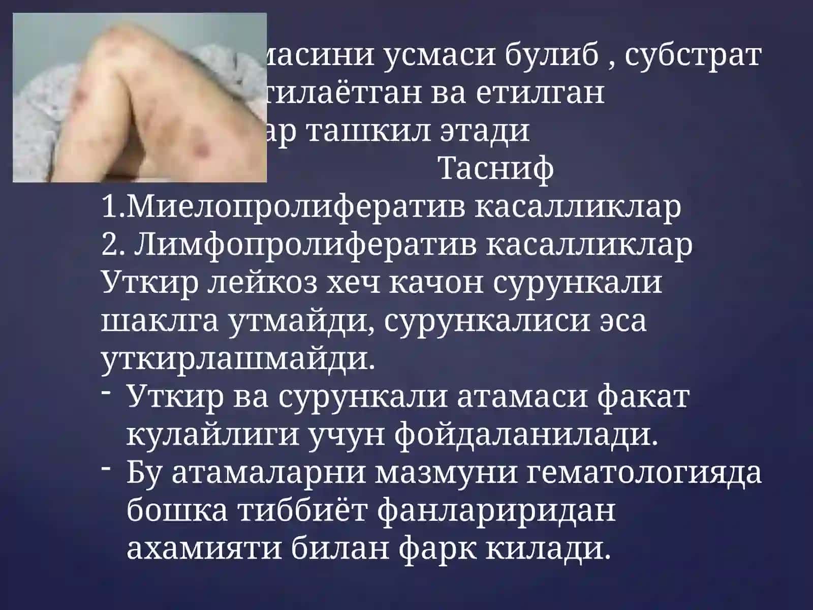 Сурункали лейкозлар 2
