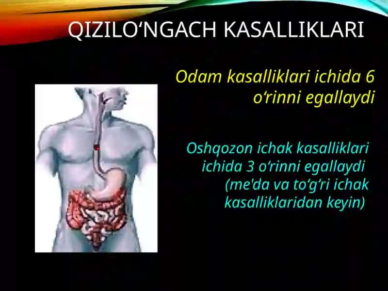 Qizilo'ngachning bo‘yin qismi rezeksiyasi 2
