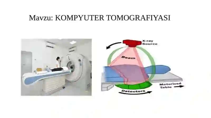 KOMPYUTER TOMOGRAFIYASI 2