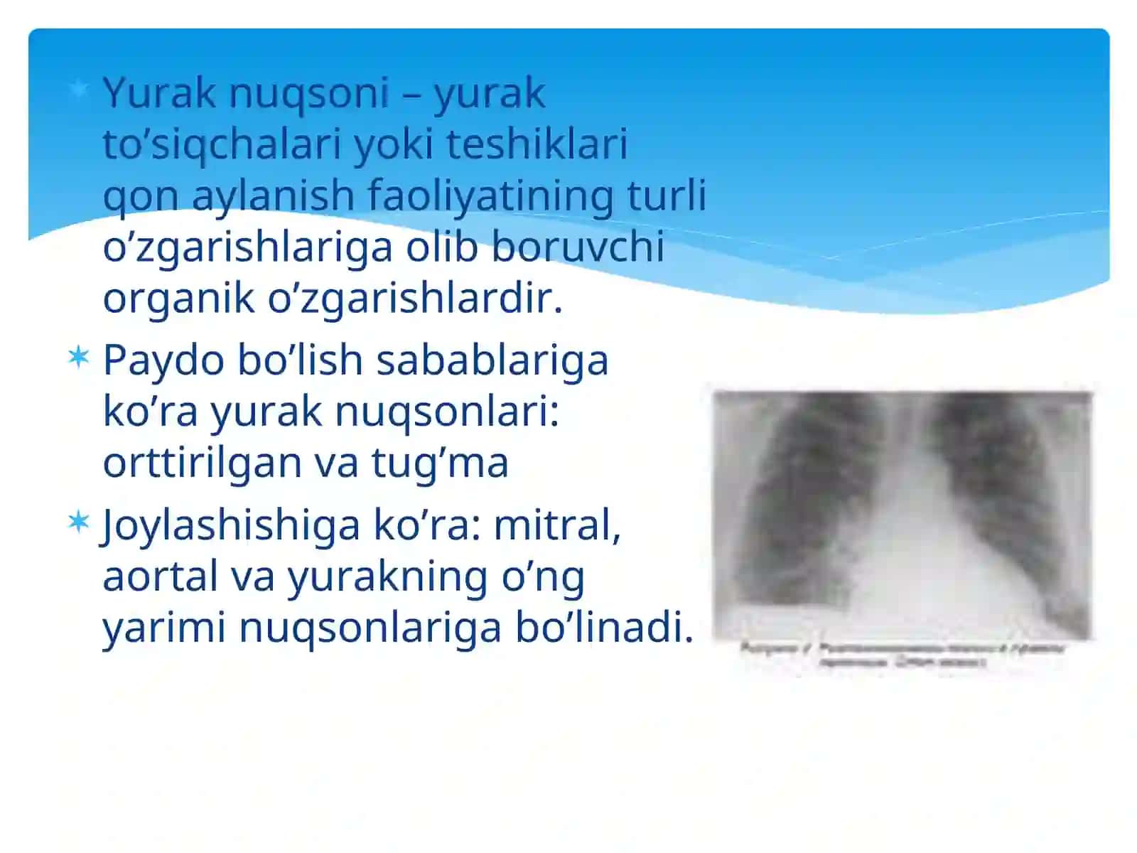 YURAKNING MITRAL POROGI VA STENOZI 2