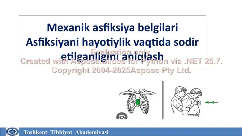 Mexanik asfiksiya belgilari 2