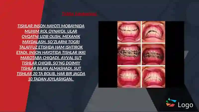 TISH QATTIQ TO‘QIMASINI TARKIBIY TUZILISHI 2