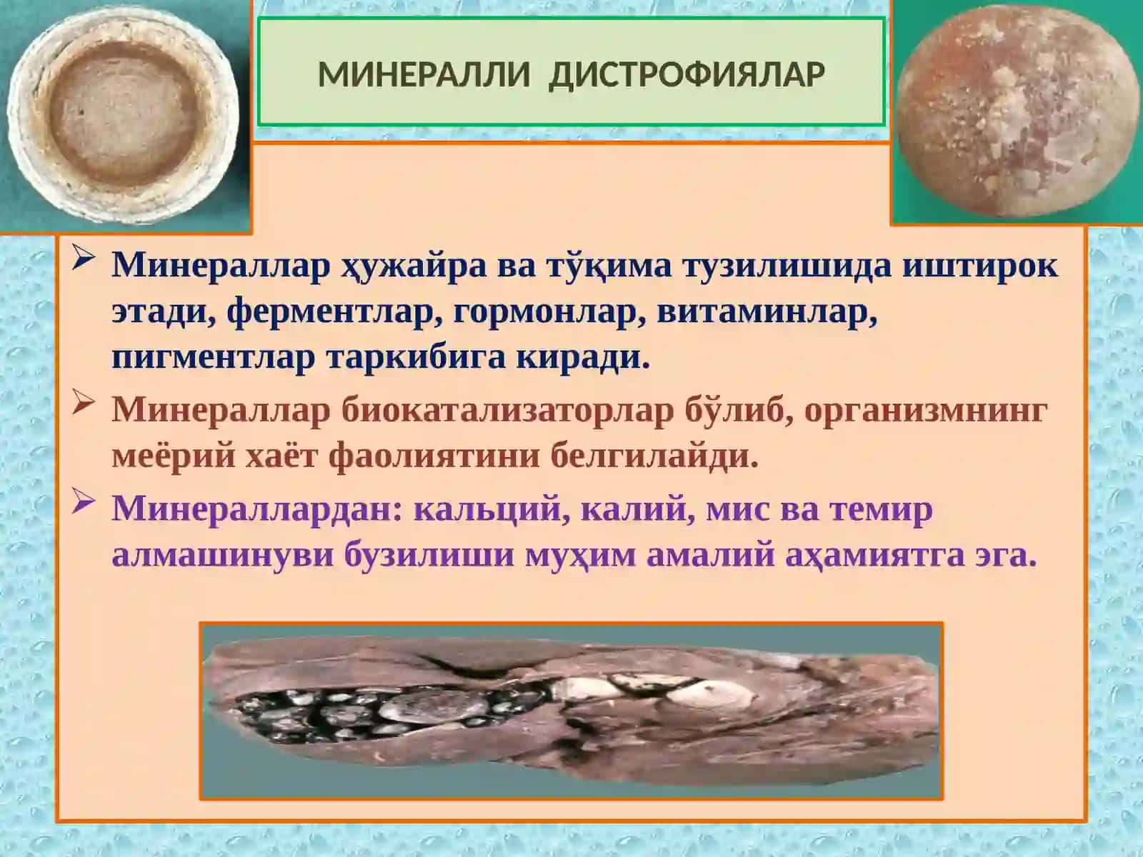 Аралаш дистрофия ва некроз. 2