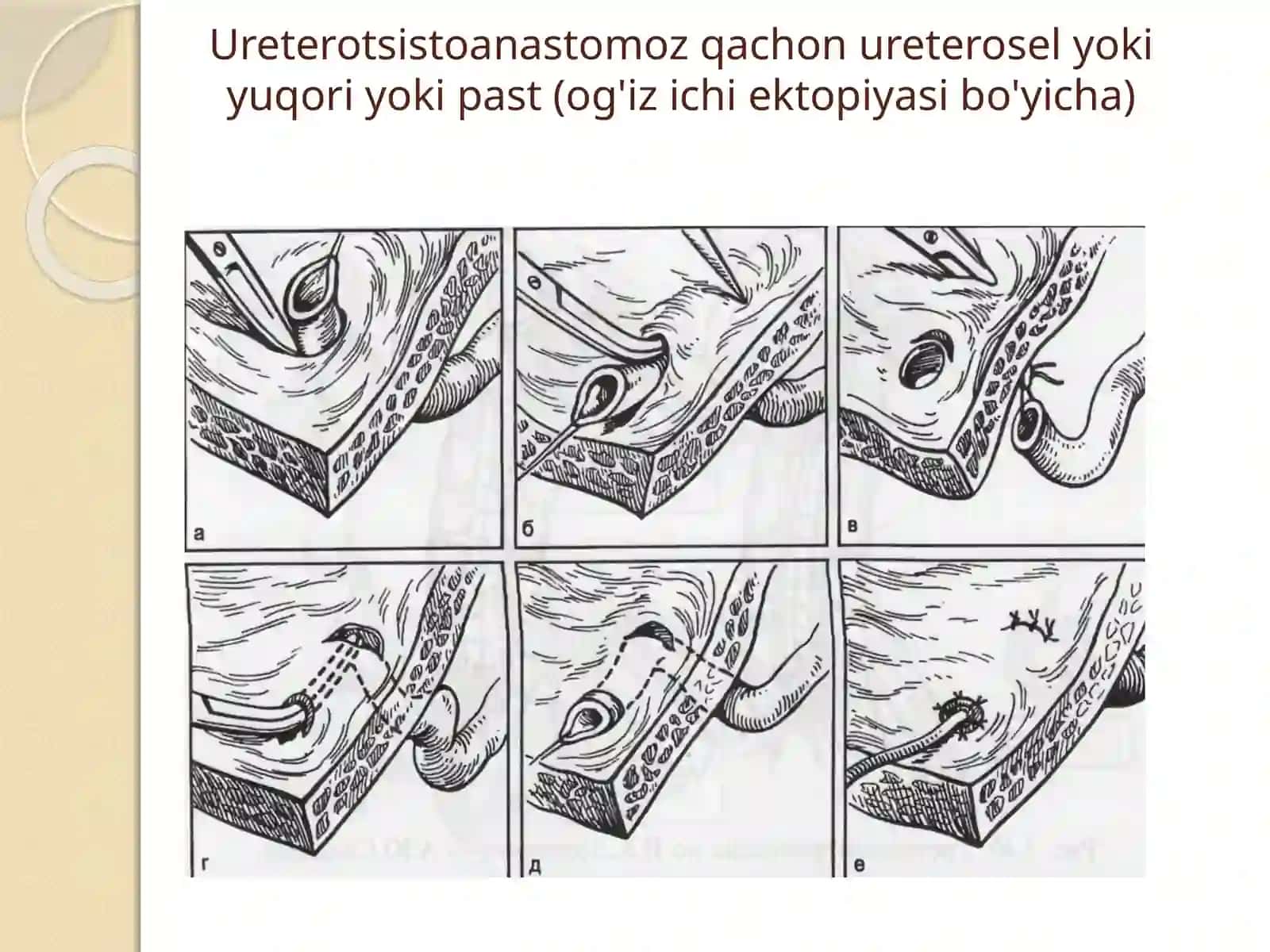 Jinsiy olat tug’marivojlanishnuqsonlari 2