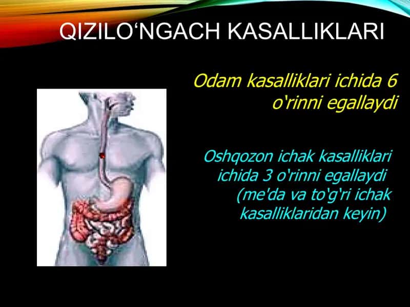 Qizilo’ngach kasalliklari 2