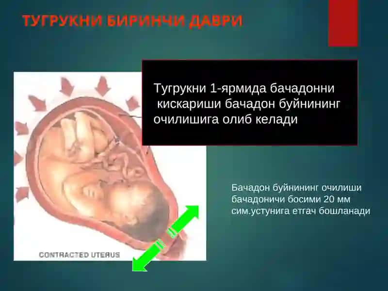 Коникарсиз туғруқ фаолияти 2