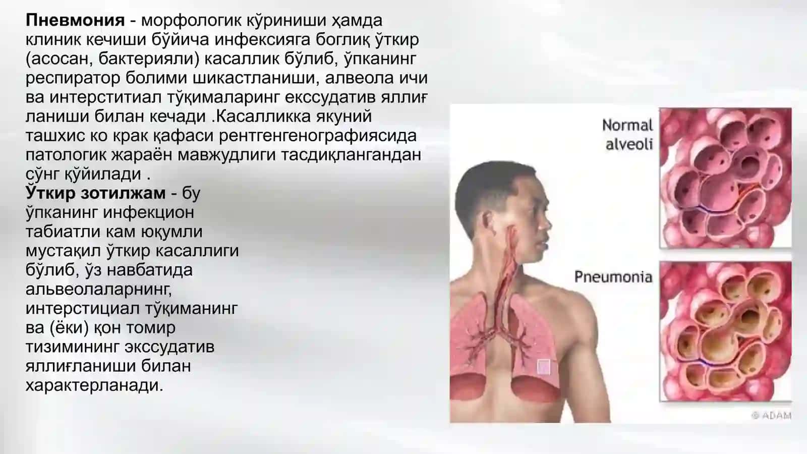 Зотилжам 2