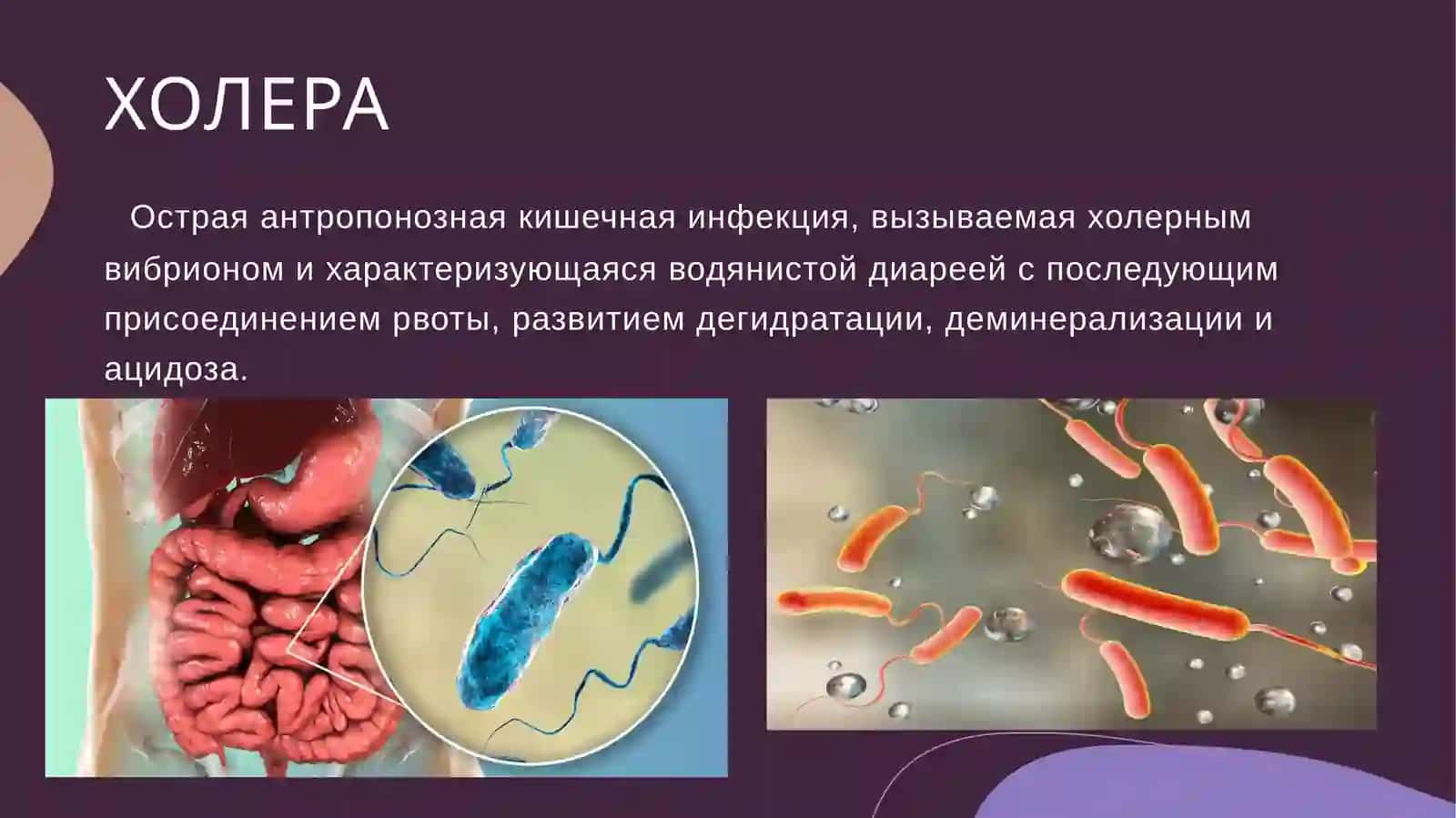 Тема:ХОЛЕРА 2
