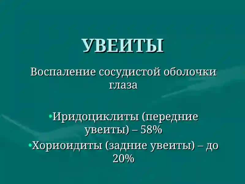УВЕИТЫ 2