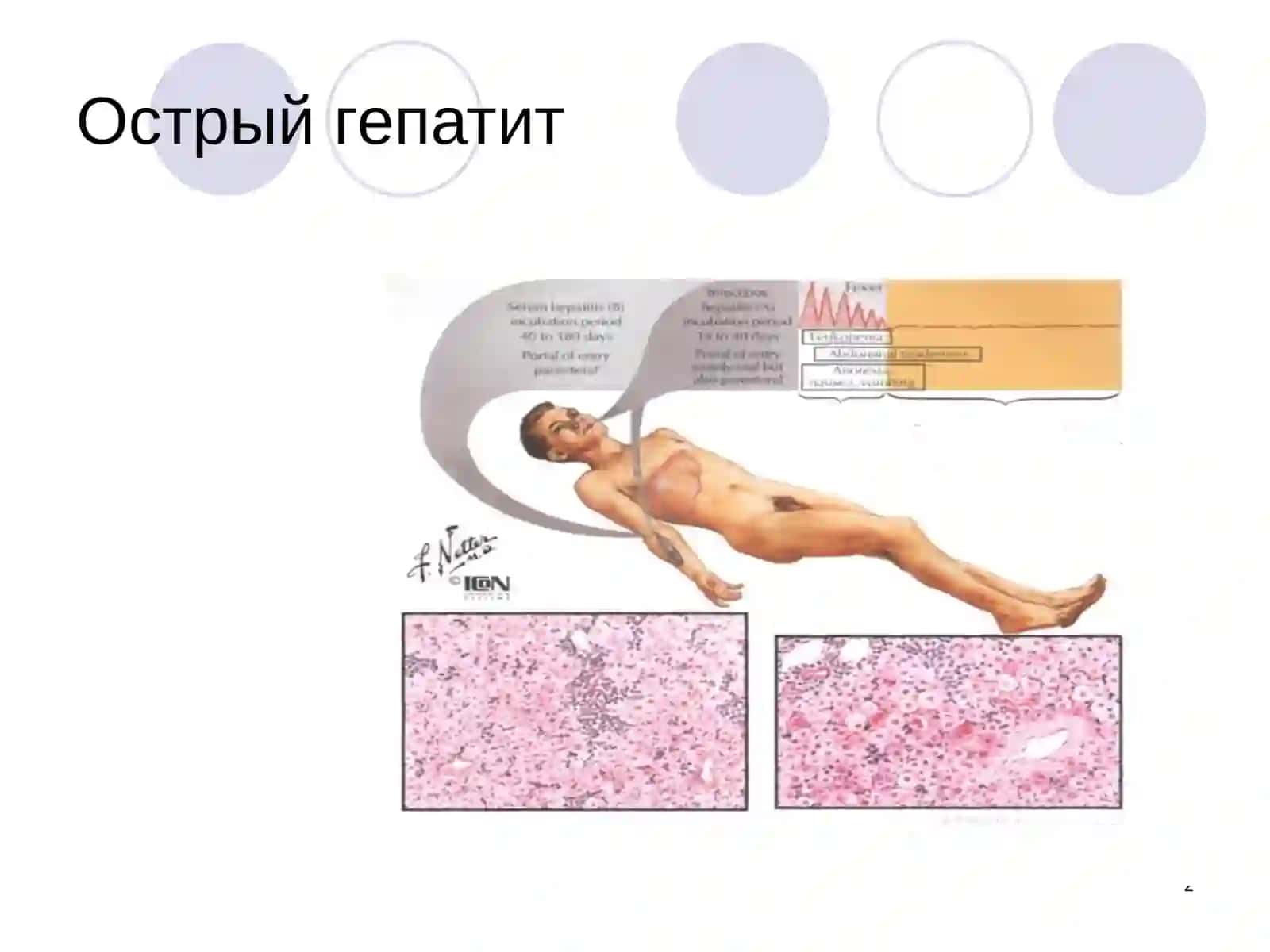 Болезни печени, желчевыводящих путей и поджелудочной железы 2