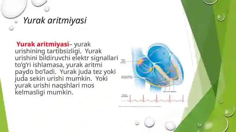 Aritmiyalarda EKG interpretatsiyasi 2
