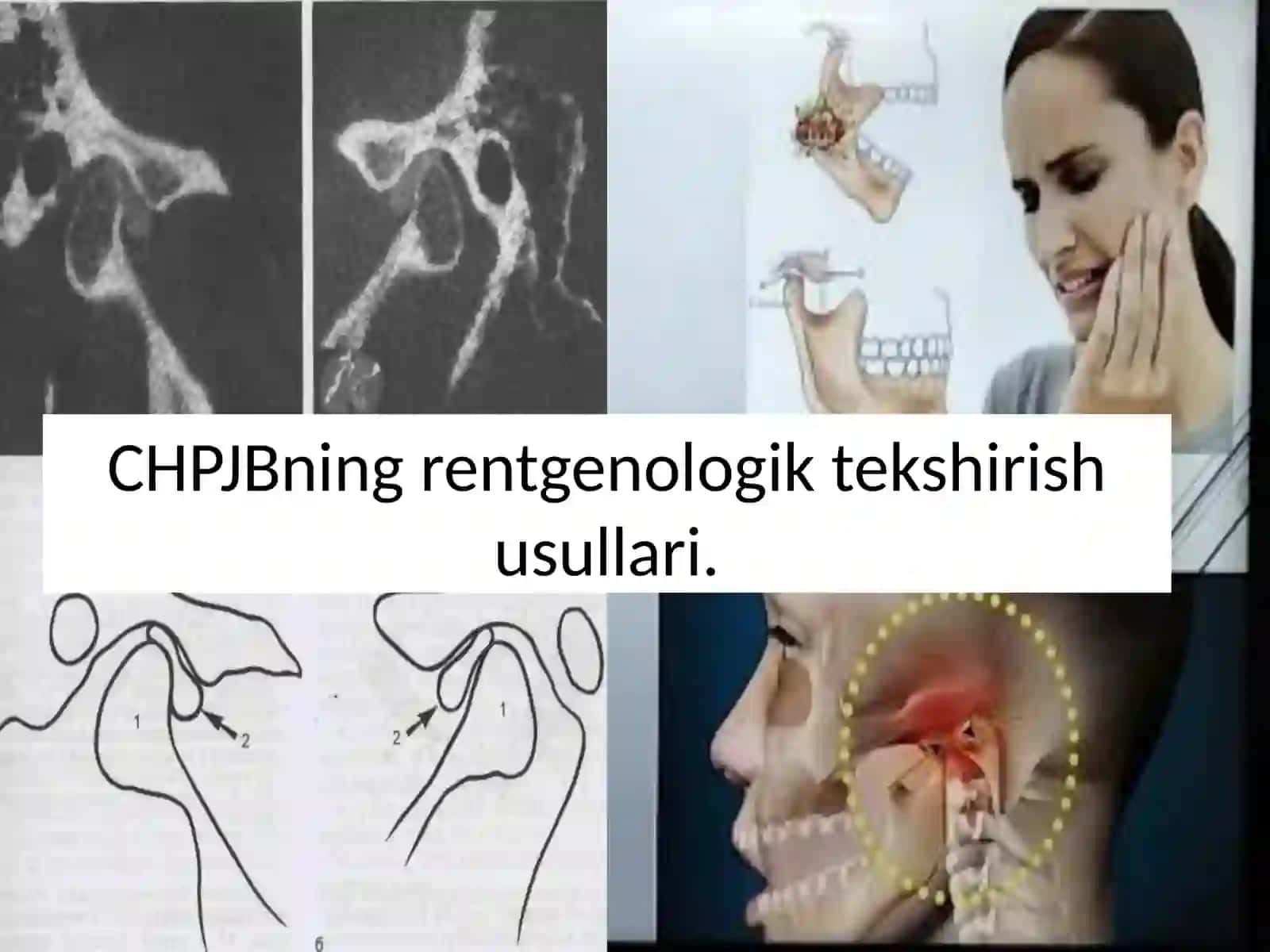 CHPJBning rentgenologik tekshirish usullari. 2