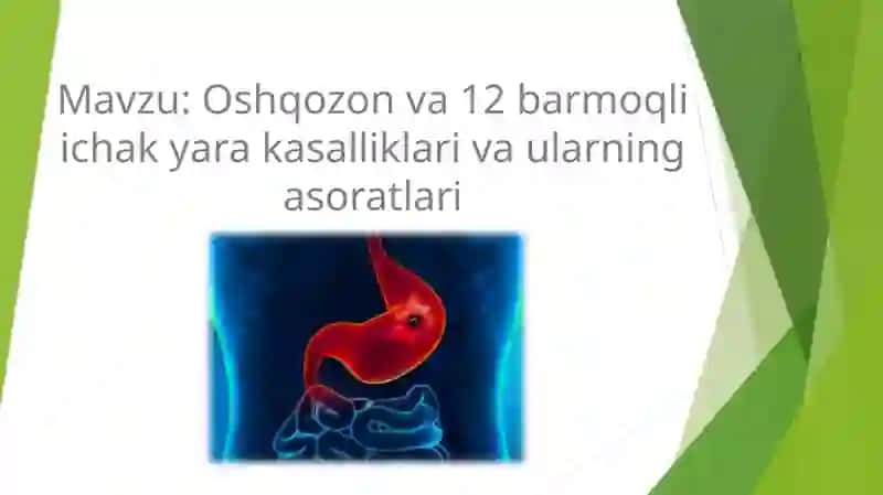 Oshqozon va 12barmoqli ichak yaralari va ularning asoratlari 2