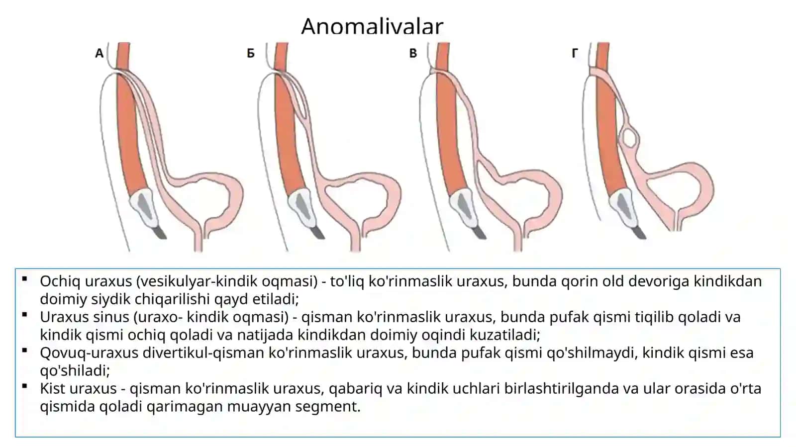Anomaliyalar uraxus 2
