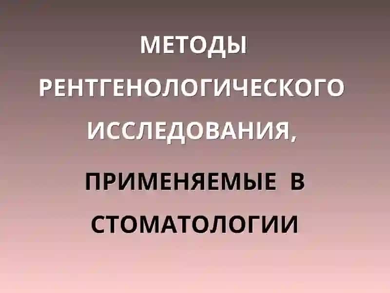 Методы рентгенологического исследования, применяемые в стоматологии 2