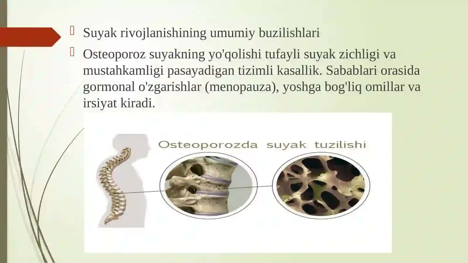 SUYAKLARNI RIVOJLANISHINI BUZILISHLARI. SINISHLAR. OSTEONEKROZ 2