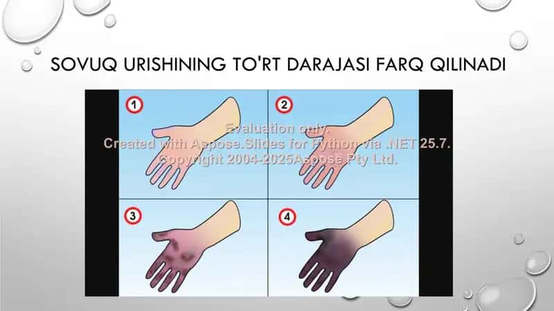 Sovuq urishi va uning o'xshashliklari 2