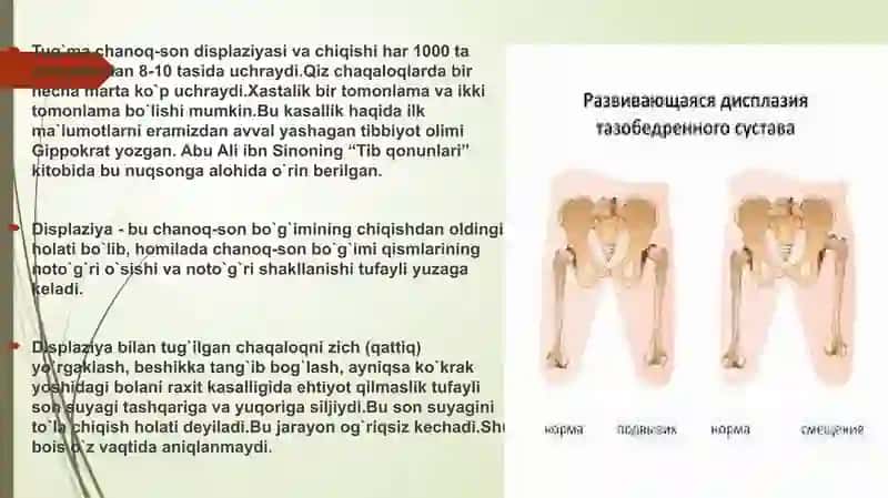 Chanoq-sont-displaziyasi davolash 2