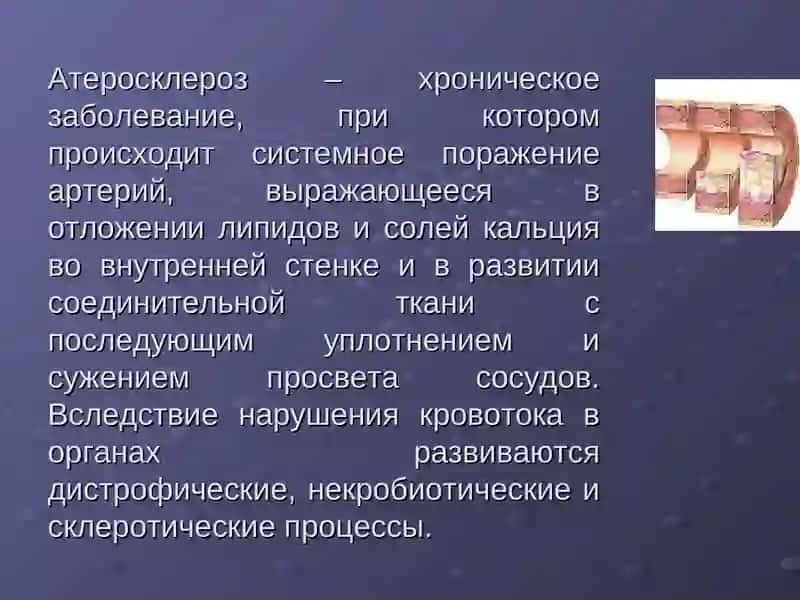 Атеросклероз нижней конечности 2