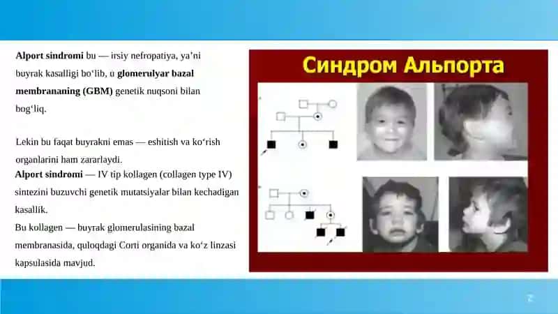 Alport sindromi 2