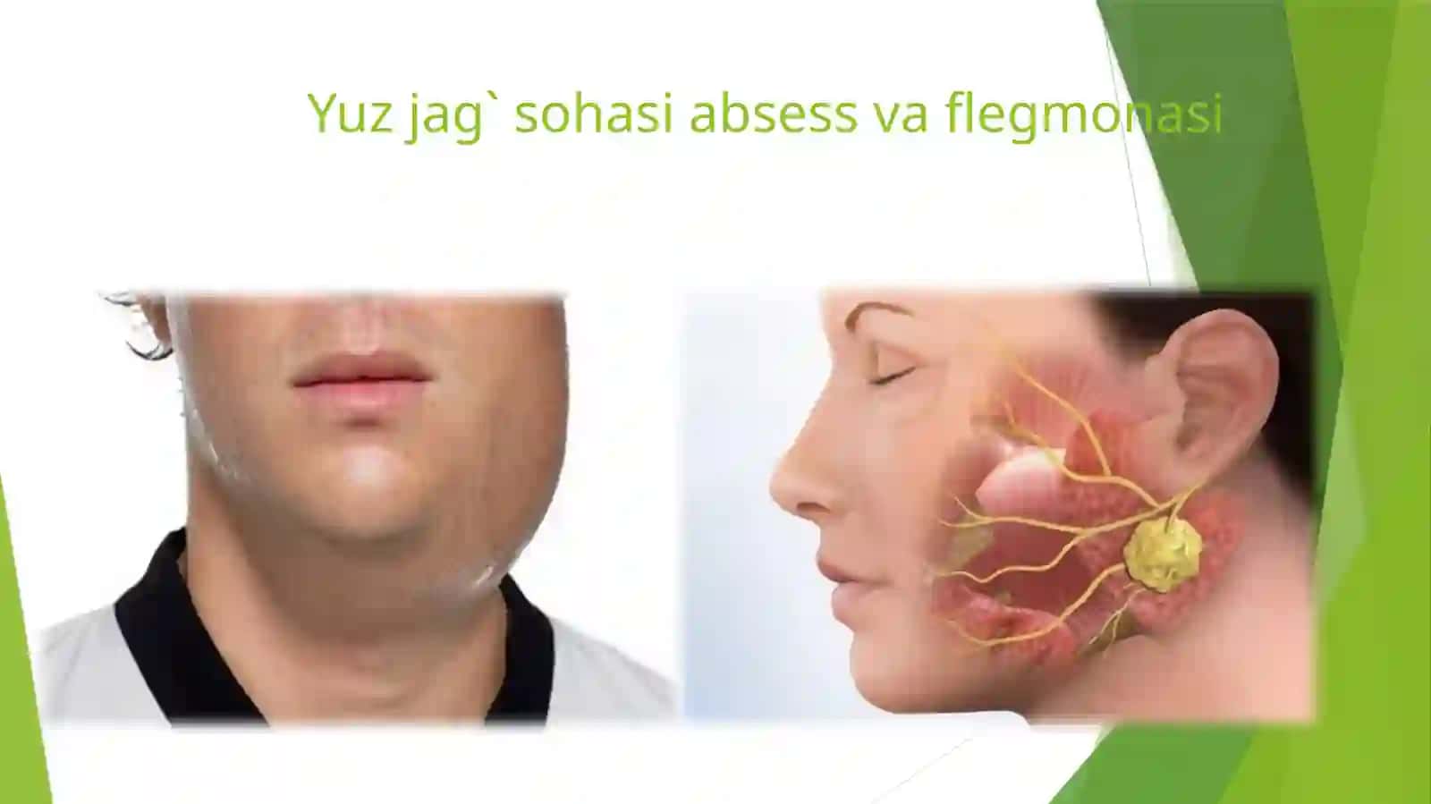 Yuz-jag` kasalliklari va jaroxatlari 2