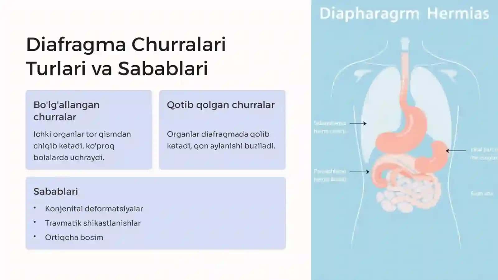 Diafragma Churralari Xirurgiyasi: Kirish 2