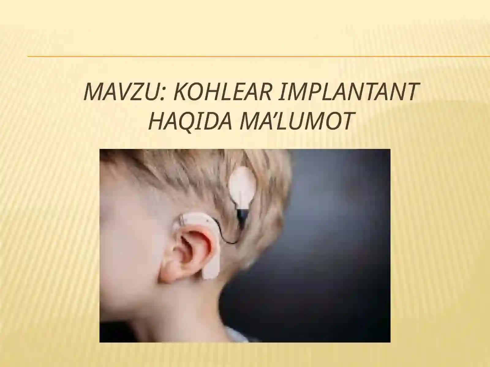 Kohlear implantant haqida ma'lumot 2