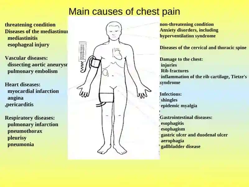 The differential diagnosis of pain in the chest 2