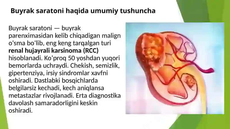 Buyrak saratonini diagnostikasi va davolash usullari 2