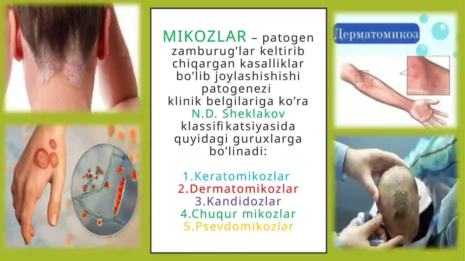 MIKOZLAR–patogenzamburug’larkeltiribchiqargankasalliklar 2