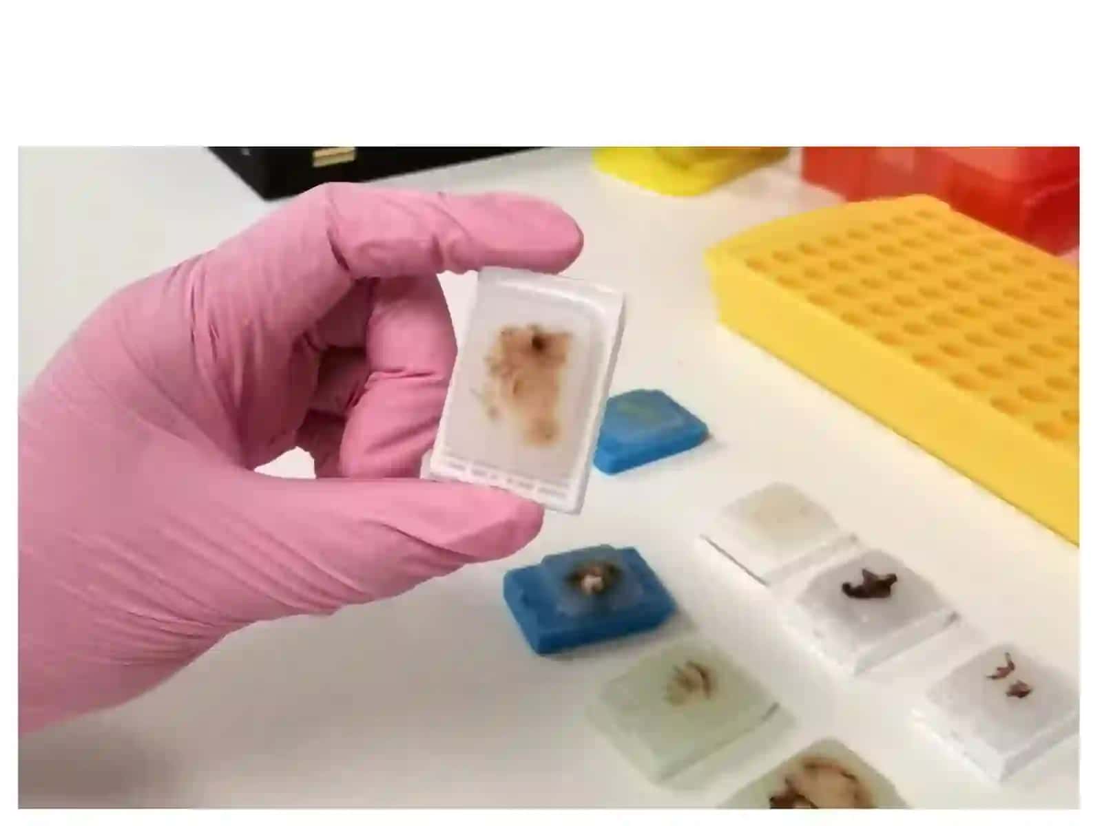 An Introduction to FFPE Tissue Preparation 2