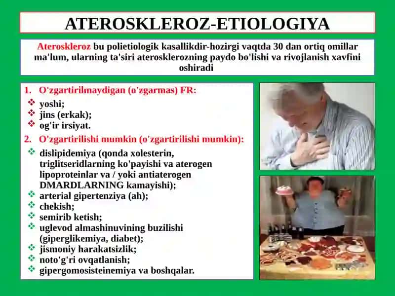 ATEROSKLEROZ-TA'RIFI, EPIDEMIOLOGIYASI 2