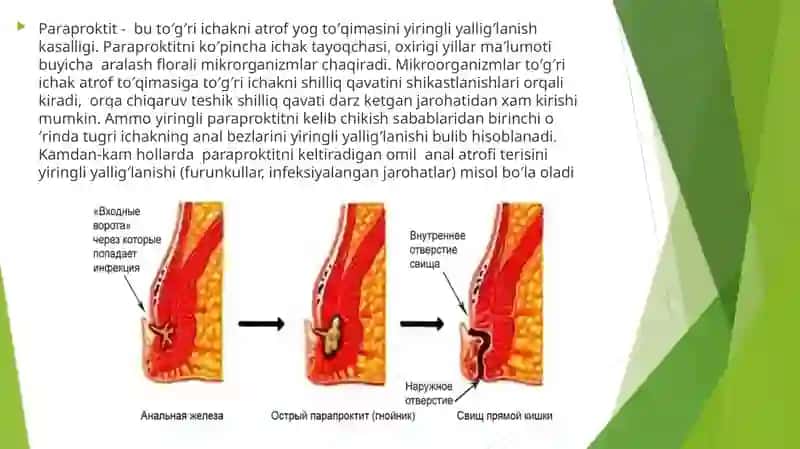 YUMSHOQ TO’QIMALAR XIRRURGIK INFEKSIYASI 2