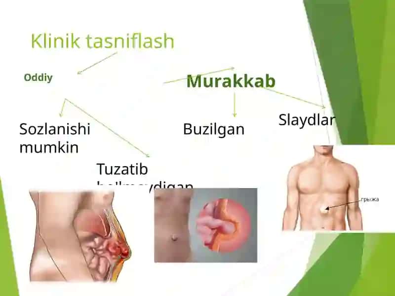 Ptiuchburchagivaoraliqchurralari 2