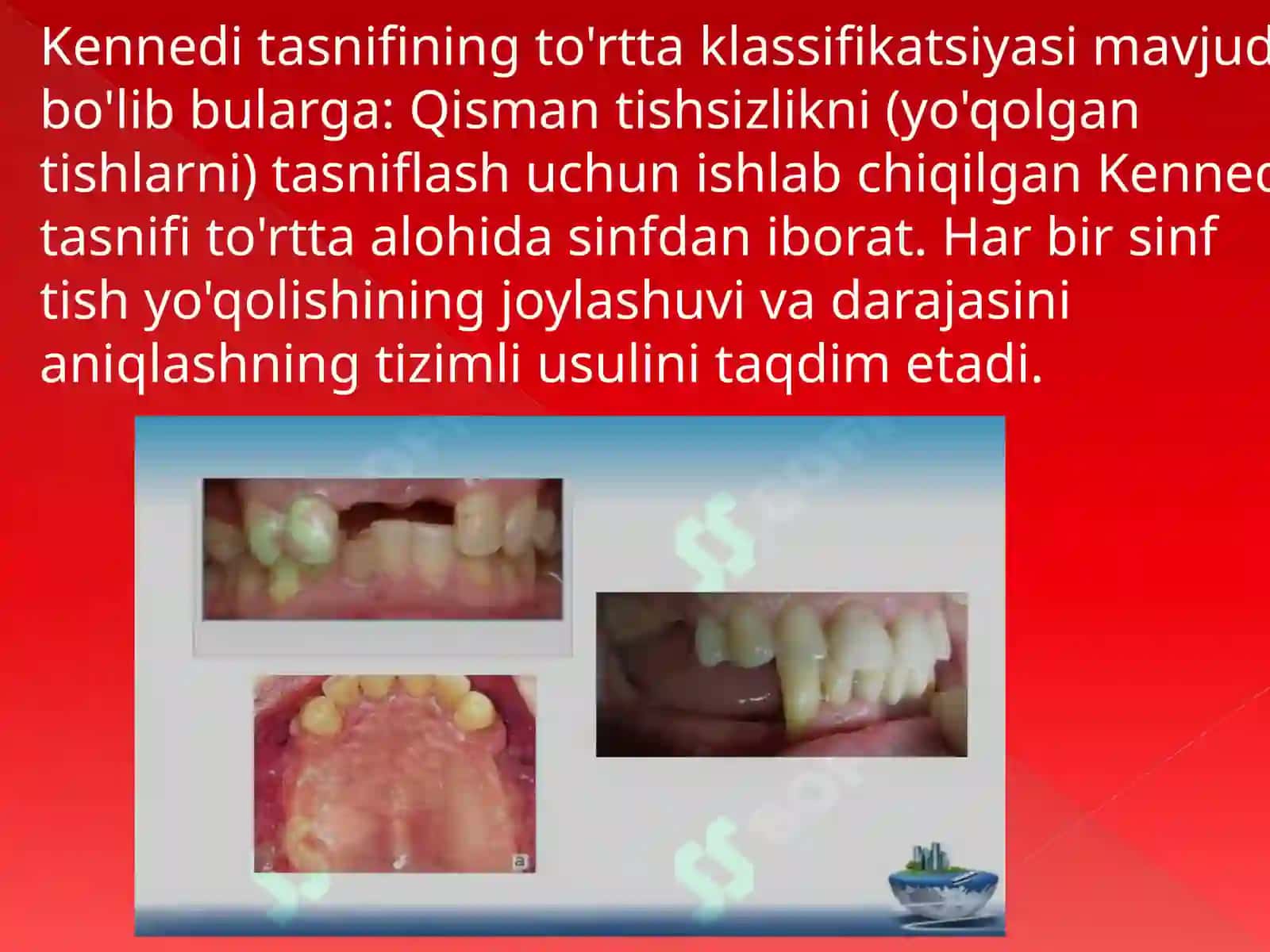 Qismantishsizlikni tasniflash 2