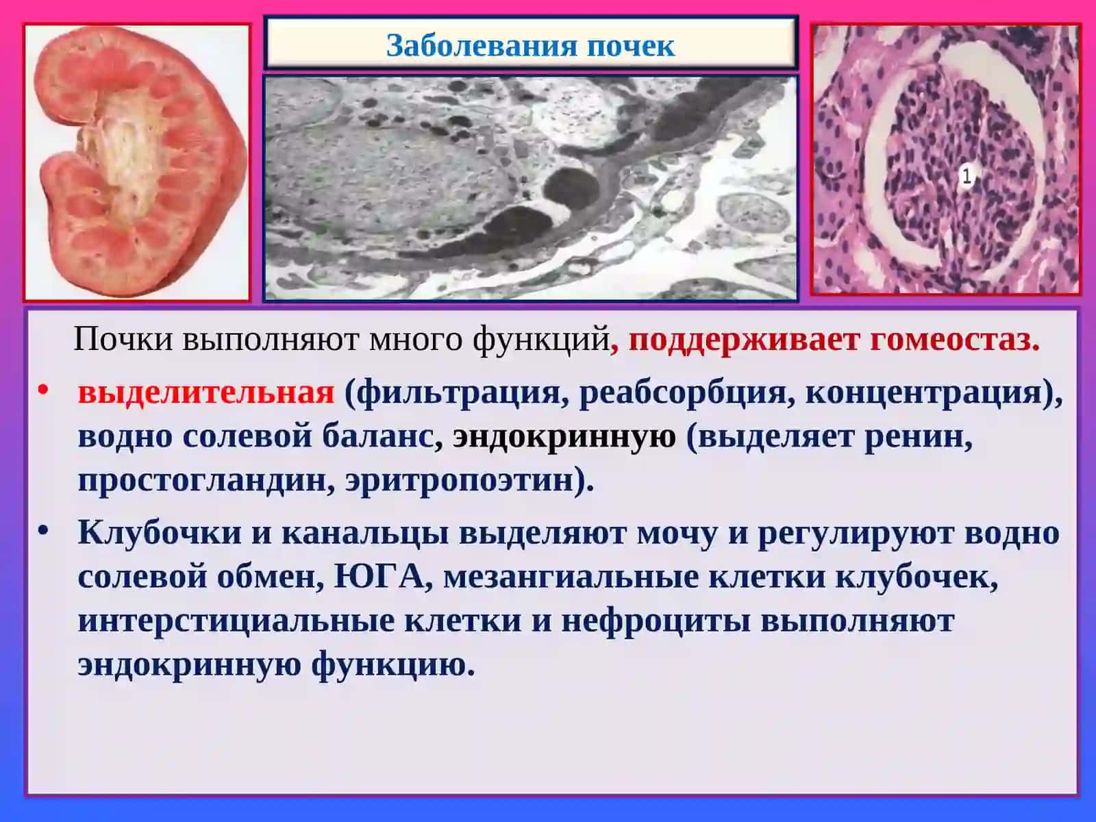 Заболевания почек 2