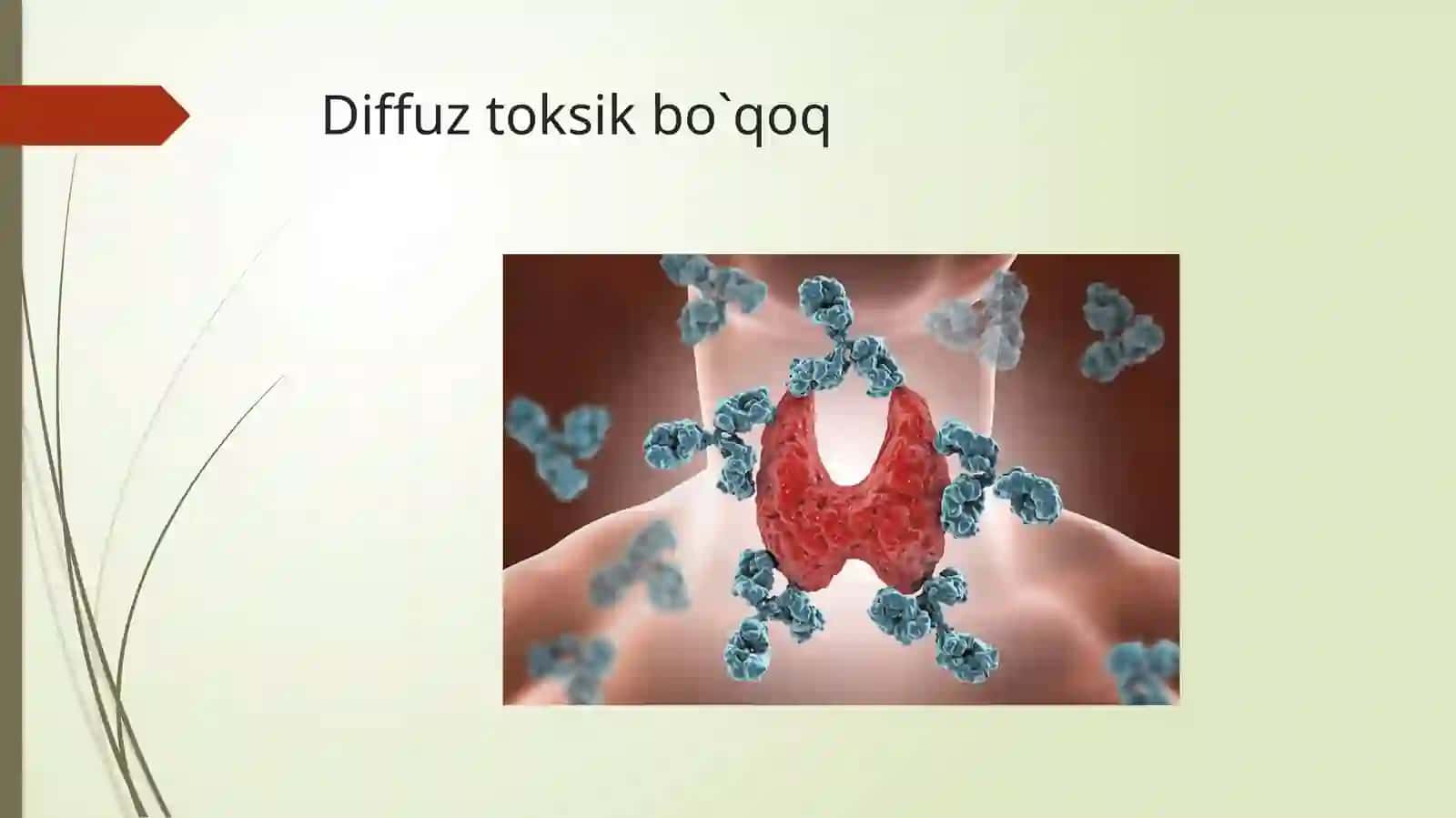 Diffuztoksik boʻqoq 2