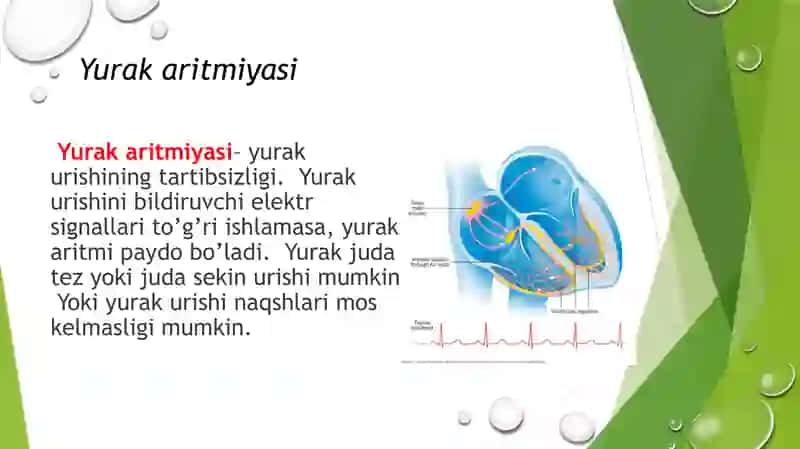 Yurak aritmiyalari EKG diagnostikasi 2