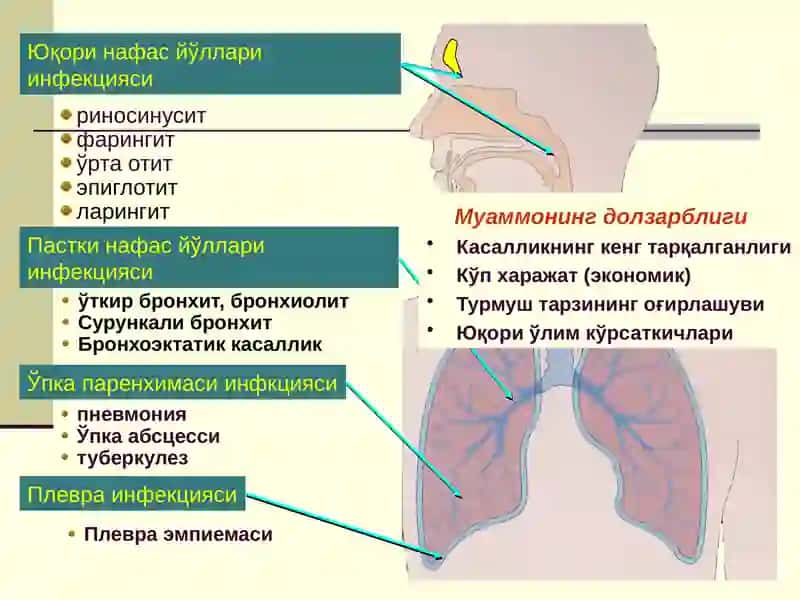 БОЛАЛАРДА ЎТКИР ПНЕВМОНИЯ 2
