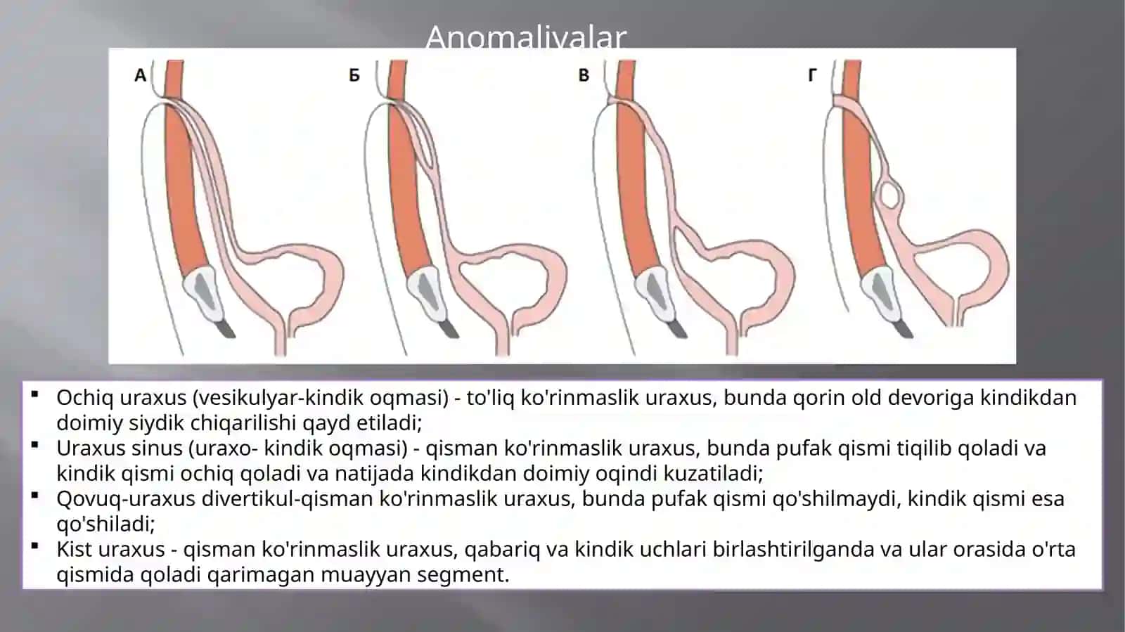 Anomaliyalar uraxus 2