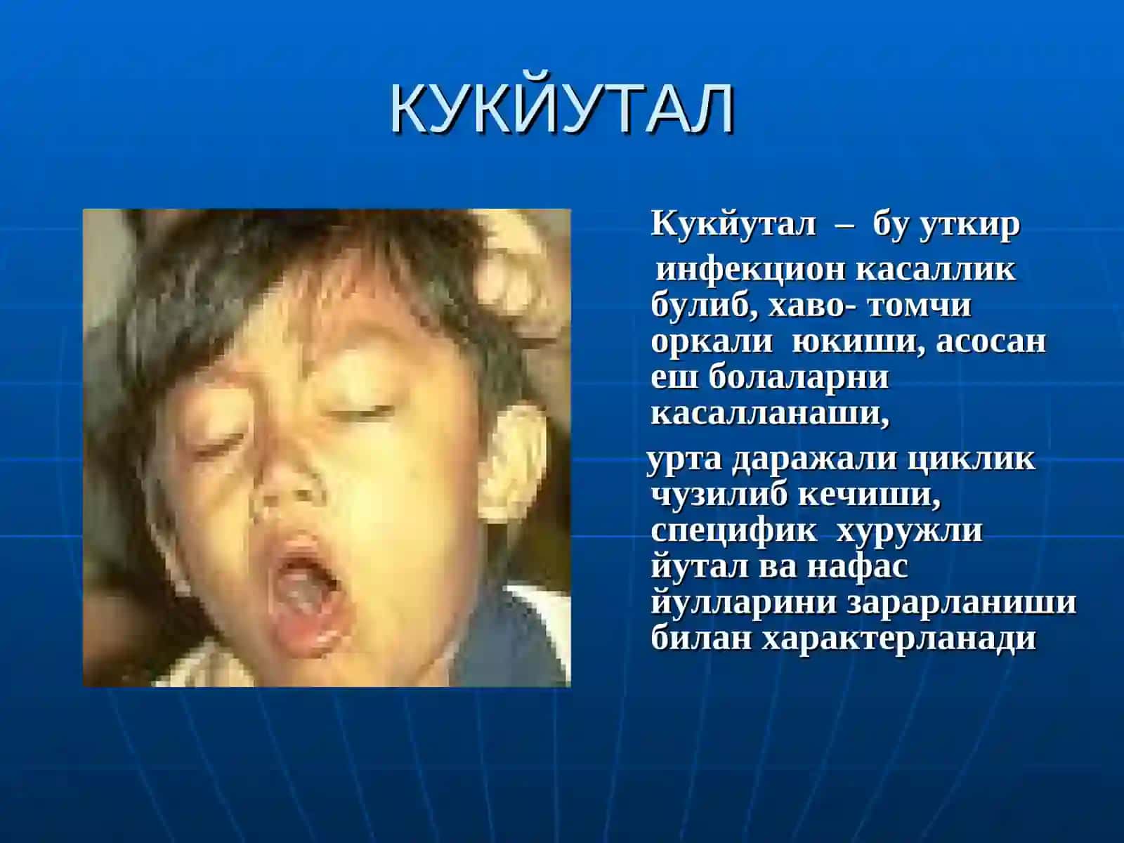 Кукйутал. Эпидемикпаротит 2