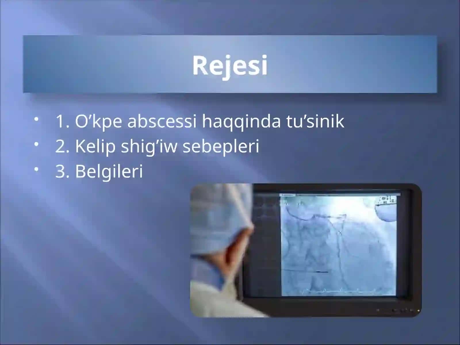 O‘kpelerabssessvagangrenasi 2
