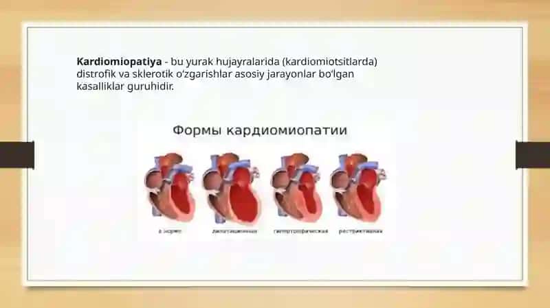 Kardiomiopatiyalar 2