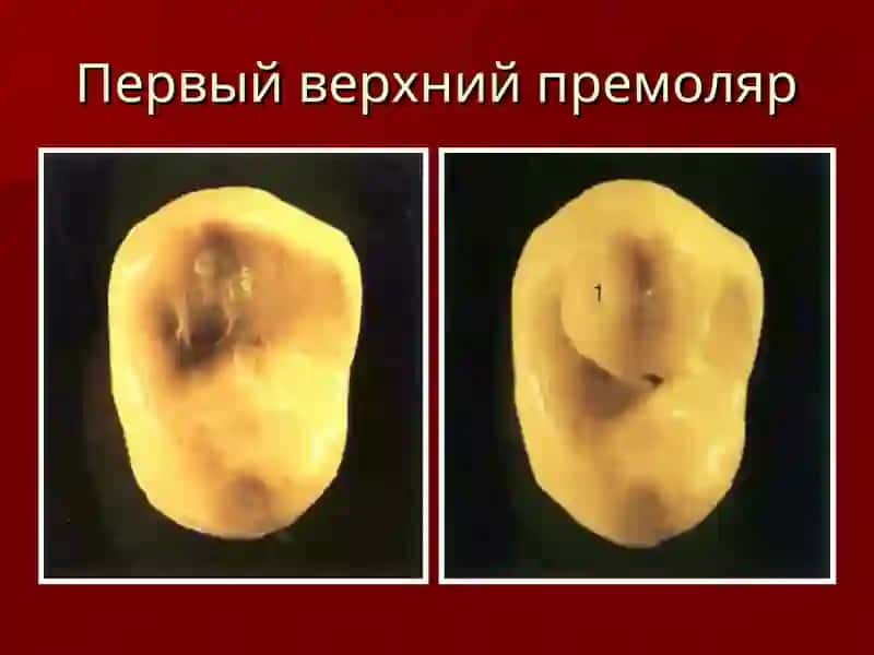 Первый верхний премоляр 2